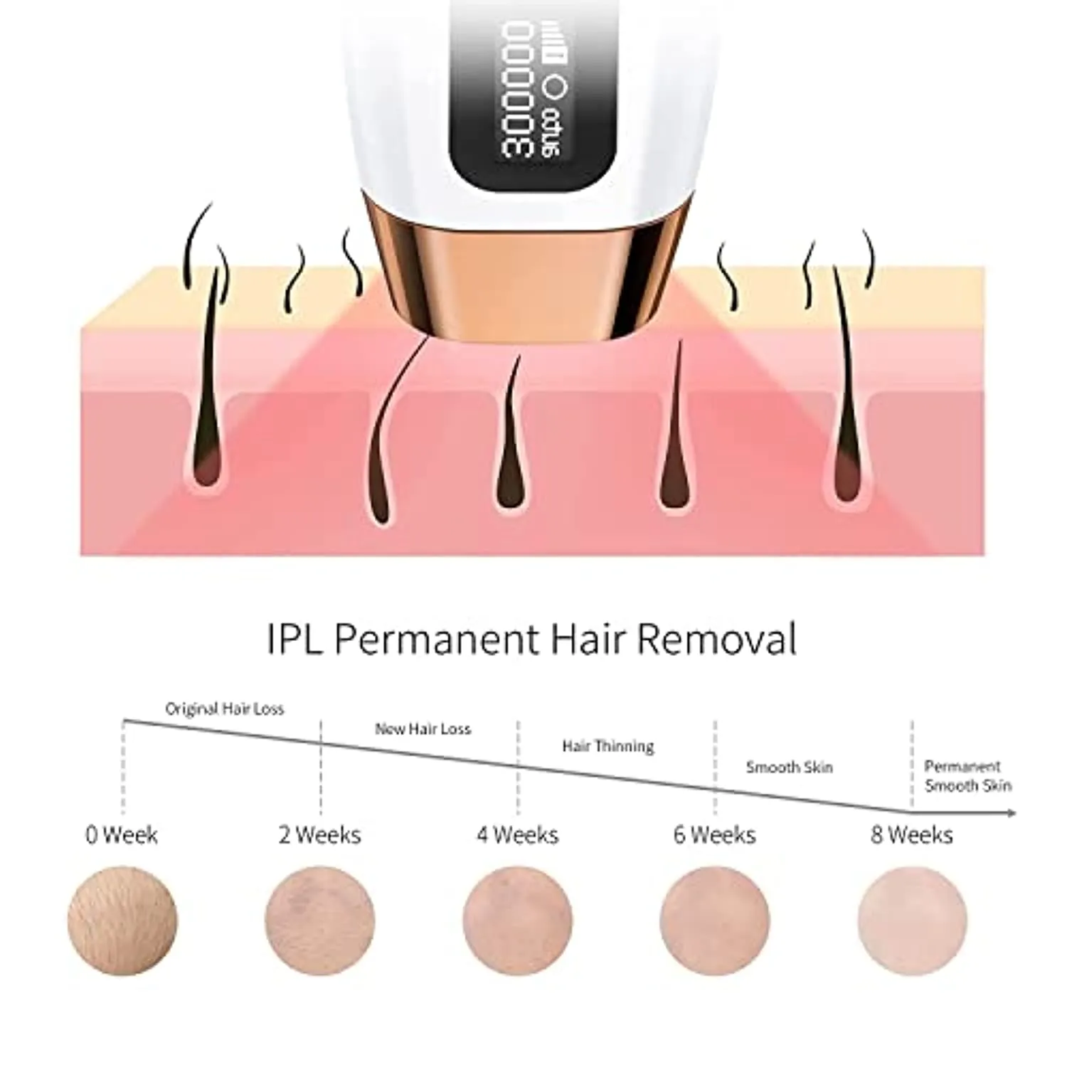 COSBEAUTY IPL Hair Removal for Women, At-Home Permanent Hair Removal Device Painless Hair Remover for Armpits Back Legs Arms Bikini Line and Facial Hair Removal (White)