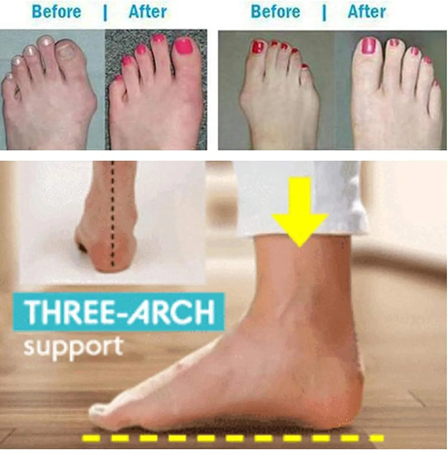 NEW Women's Orthopedic Correction Leather Ring Toe Casual Bunion Slippers Summer Casual Beach Sandals Flat Heel Flip Flops, Black, Sz 9.5
